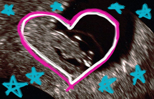 baby money 2 sonogram